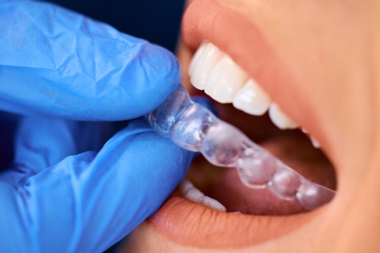 Close up of dentist placing invisible dental aligners on woman's teeth