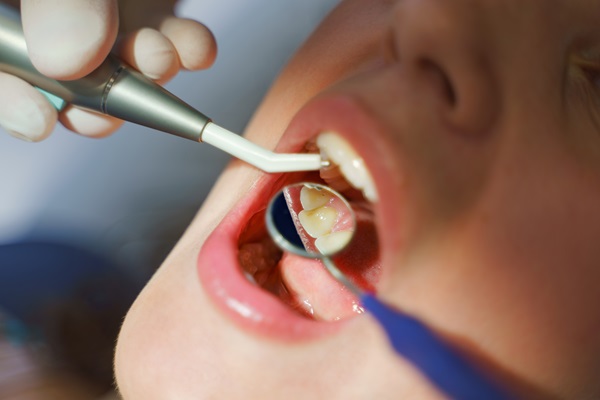 Close-up of young woman at dental examination in ambulance.