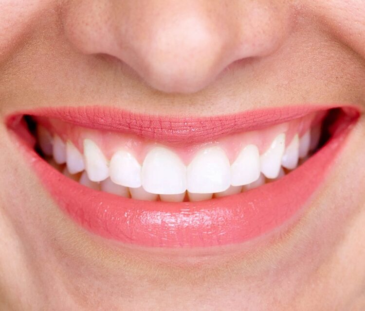 closeup of smile with white healthy teeth