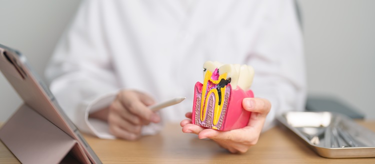 Dentist with tooth Anatomy model. Oral Teeth decay and disease,